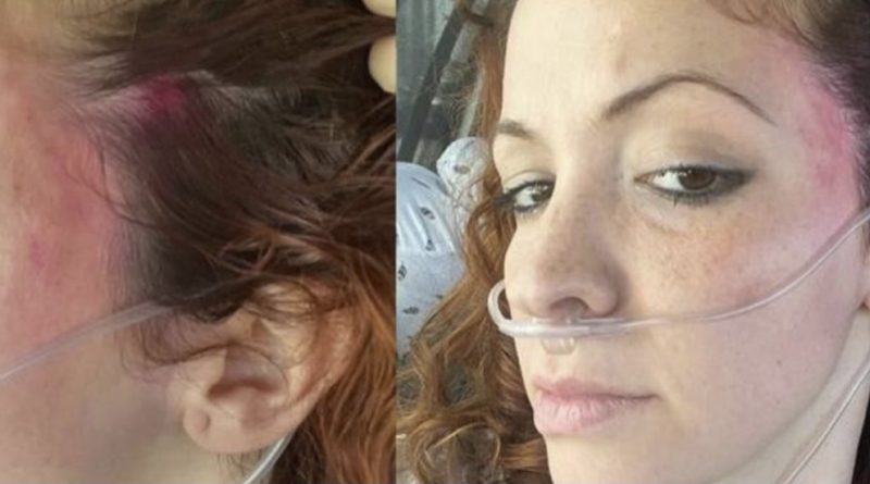 Agresión con una piedra a una vocal de Vox